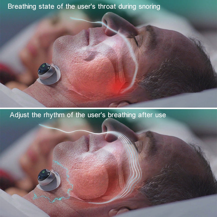 Adult Home Smart Throat Anti-snoring Device Sleep Stickers
