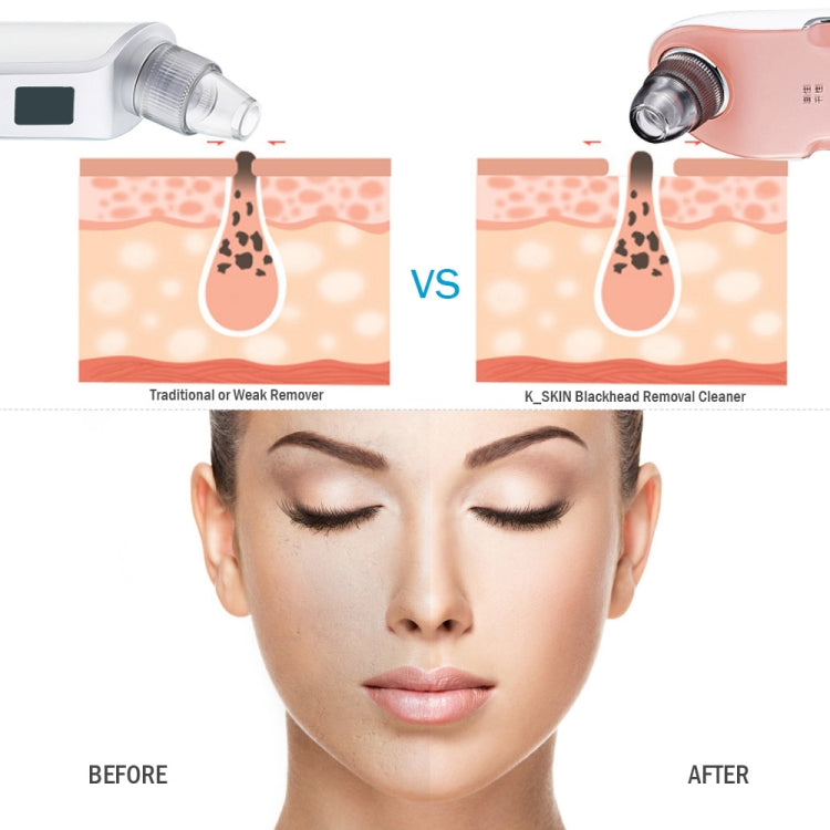 K-SKIN 3 Level Intensity Blackhead Removal Pore Cleaner Suction Rechargeable Black Spot Cleaner Facial Cleaning Machine