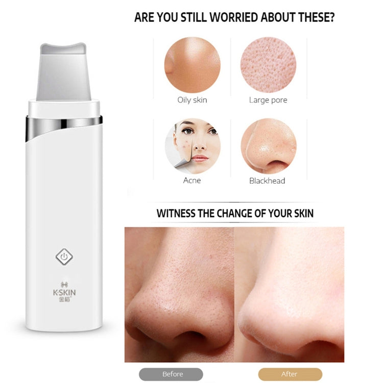 K-SKIN KD-8023Ultrasonic Blackhead Acne Removal Pore Cleaner Facial Skin Care Scrubber Exfoliating Pore Cleaner