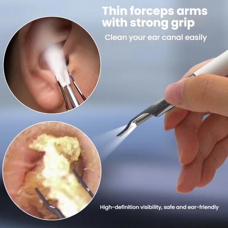 P5 Smart WIFI Connection Visible 10 Million Pixel HD Detachable Ear Spoon With APP